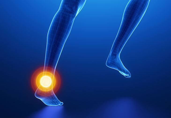 Australian Runner Genevieve Gregson Ruptures her ‘Good Achilles’. 1 Australian Runner Genevieve Gregson Ruptures her ‘Good Achilles’.